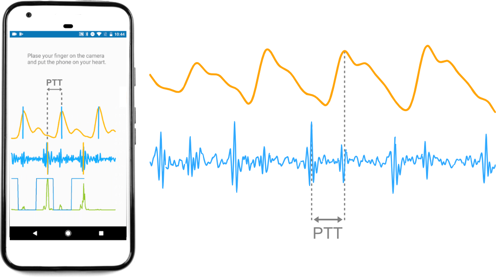 illustration of real time pulse transit time sensing: the camera measures PPG, the accelerometer measures SCG, and the time difference between them is the PTT